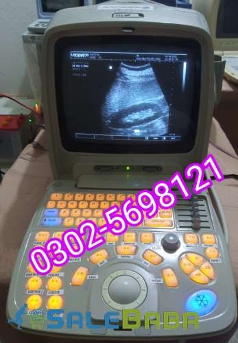 Used Portable ultrasound machine For sale,