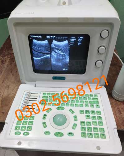 China ultrasound machine available in stock