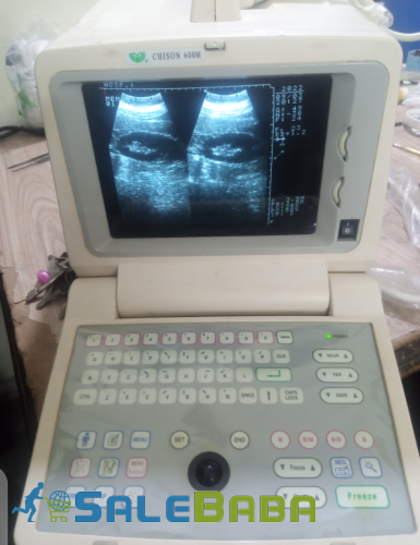 China used ultrasound machine