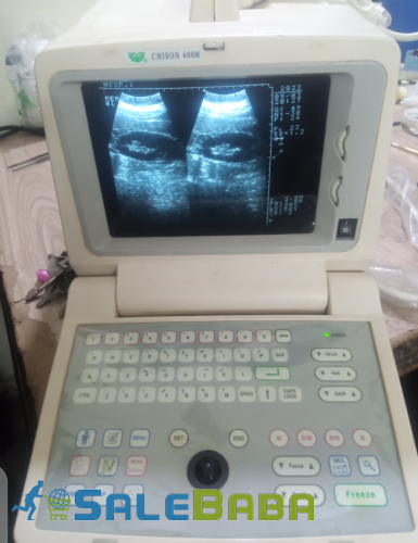 Used china ultrasound machine Portable