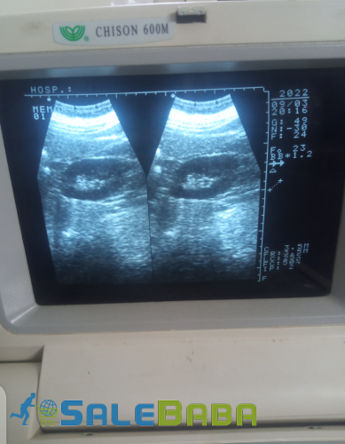 Used china ultrasound machine Portable