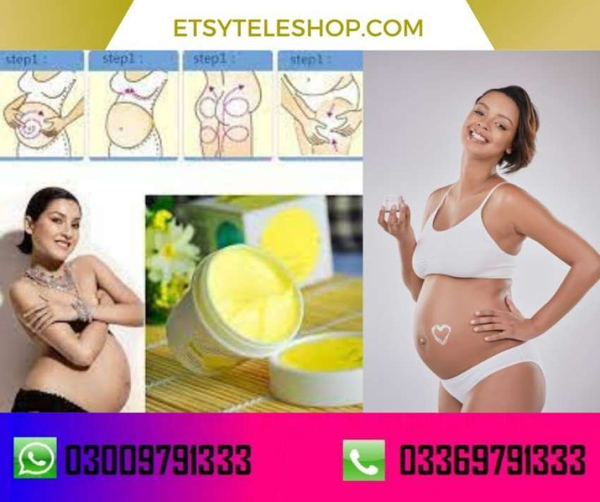 Pasjel Stretch Mark Cream Price in Pakistan  EtsyTeleShop