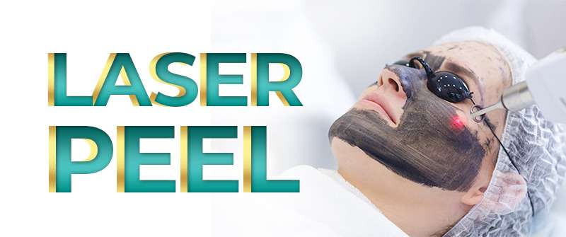 Laser Carbon Peel Treatment in Islamabad  Rehman Medical Center