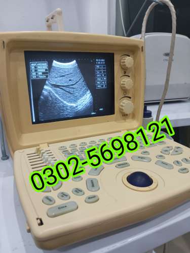 Used Portable ultrasound machine for sale
