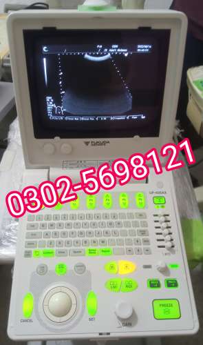 Aloka prosound6 ultrasound machine for sale