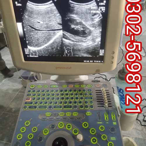 Aloka prosound6 ultrasound machine available