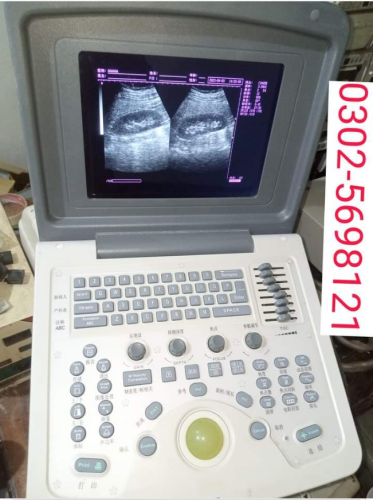 Portable ultrasound machine available in stock