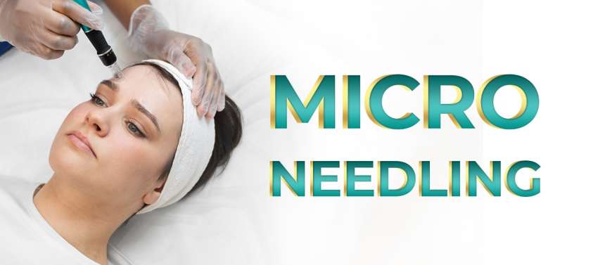 Microneedling Facial Treatment in Islamabad  R M C