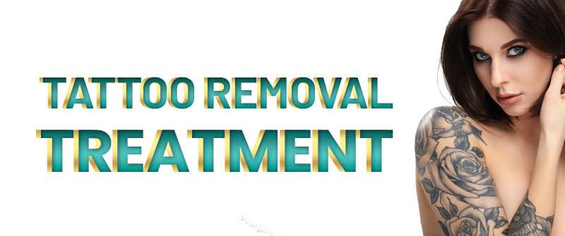 Laser Tattoo Removal in Islamabad  Rehman Medical Center