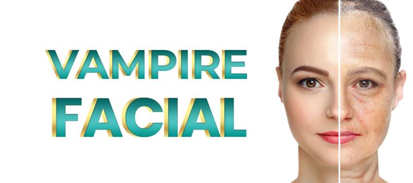 Vampire Facial Cost in Islamabad  Rehman Medical Center