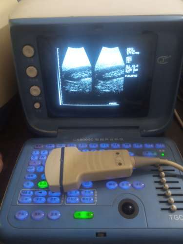 Use portable ultrasound machine for sale