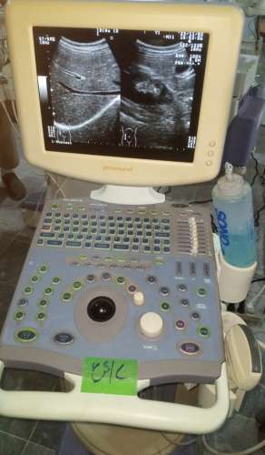 Aloka prosound6 ultrasound machine available