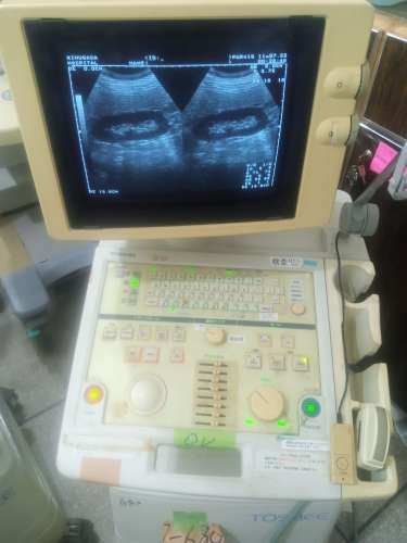 Aloka prosound6 ultrasound machine available