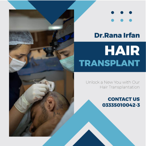 Hair transplant services in Pakistan