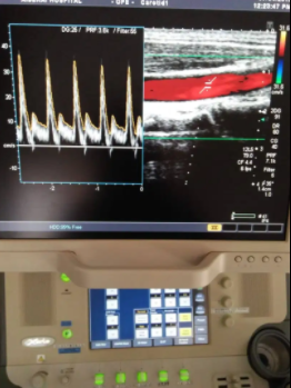 Toshiba Nemio MX Xario XG Color Doppler Best price in Pakistan for Sale