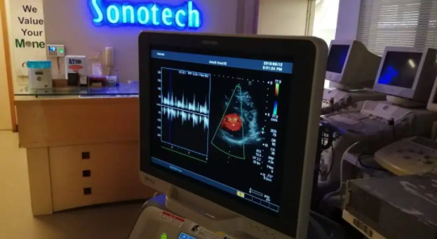 Toshiba Nemio MX Xario XG Color Doppler Best price in Pakistan for Sale