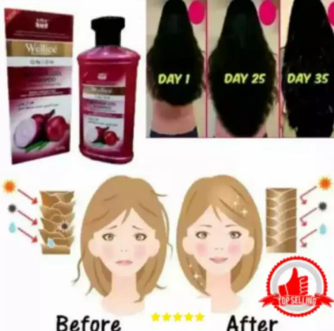 NEW Wellice Professional ONION ANTI HAIR LOSS SHAMPOO FOR SALE
