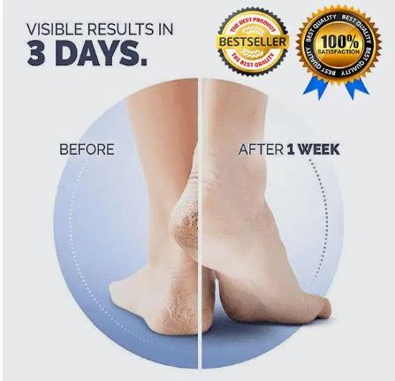 Anti Crack Pain Reliever Heel Protector Nourishment Solution Reusable