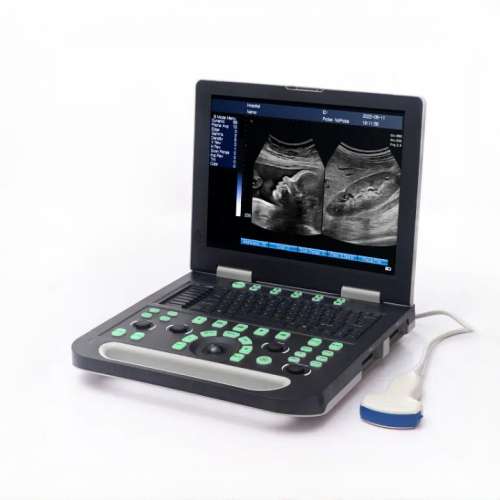 Brand new N50 Notebook 15 LED Ultrasound machineSurgical Hut