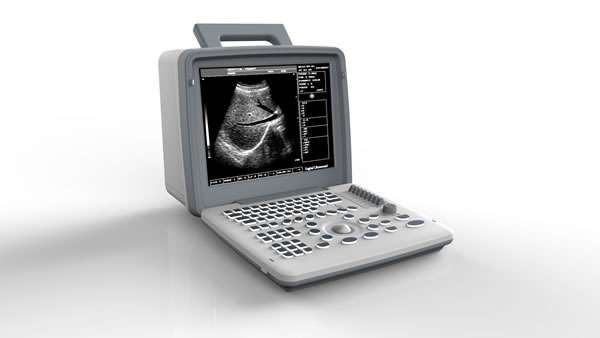 Apollo 7  LCD Portable Ultrasound MachineSurgical Hut