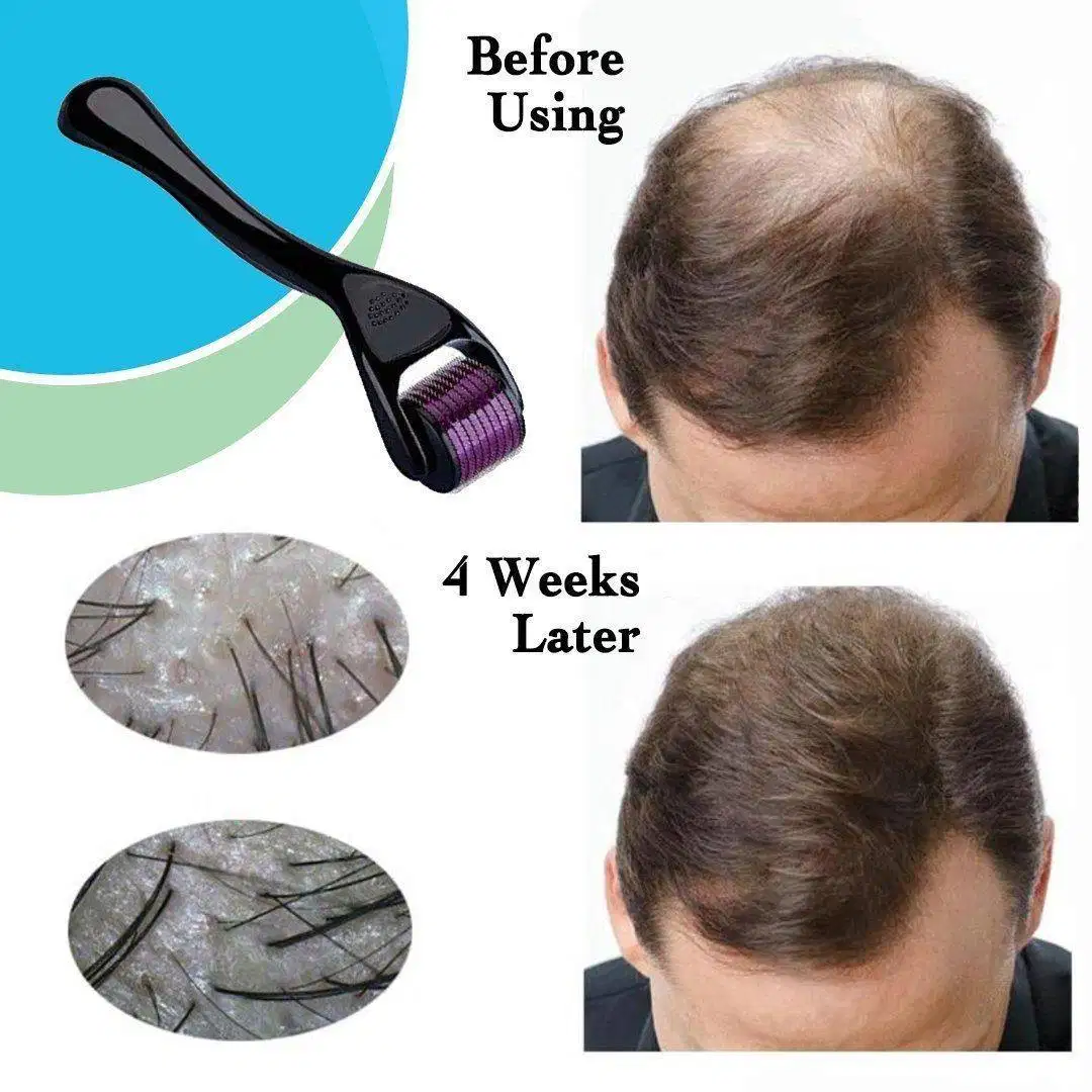 Derma Roller System 540 Micro Needles 0.5 Or 1 mm (ANTI-AGEING)